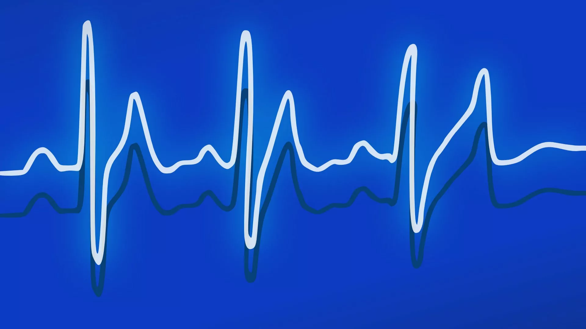 Das Anspannen und Entspannen der Beckenbodenmuskulatur wird häufig ähnlich wie in einem Herzmuskel EKG dargestellt.