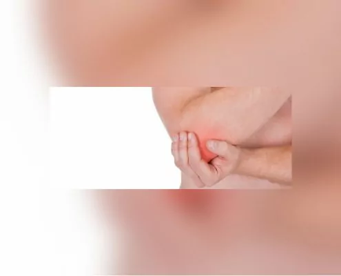 Fibromyalgie Faser-Muskel-Schmerz