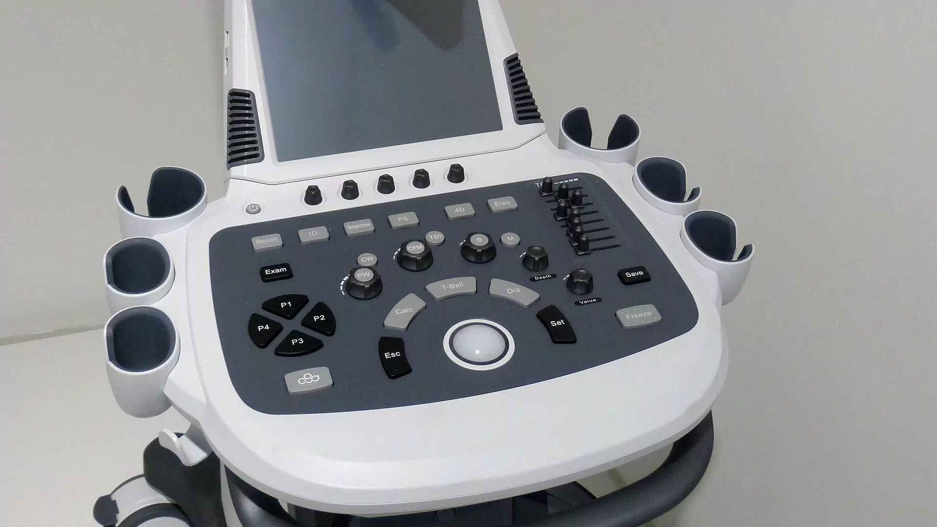 Durch die Sonographie kann mittels Ultraschall ein Rotatorenmanschettenriss erkannt werden.
